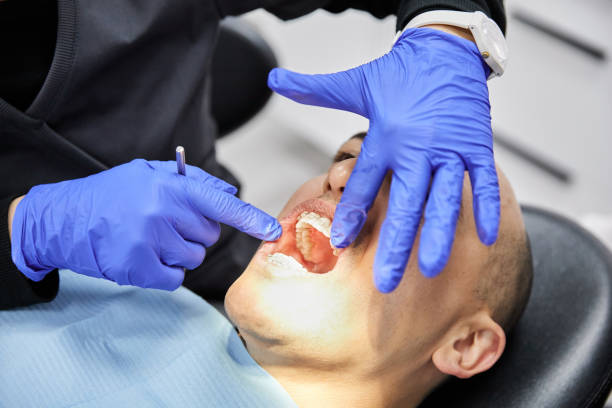 Best Emergency Dental Surgery in Nassau Bay, TX